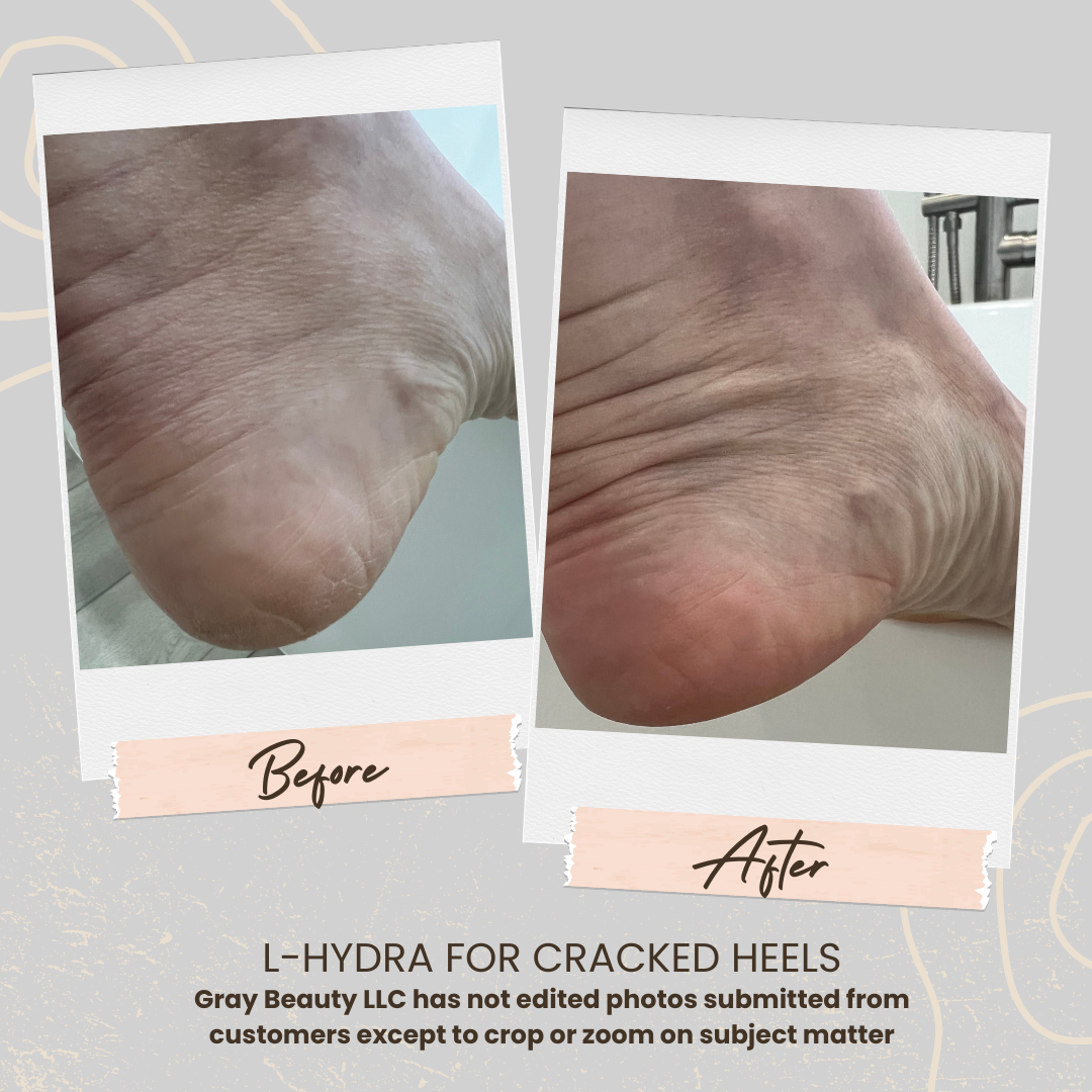L-Hydra Moisturizer